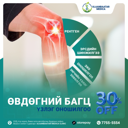 Улаанбаатар медика: Өвдөгний багц үзлэг, оношилгоондоо цагаан сар хүртэл хямдрал зарлалаа